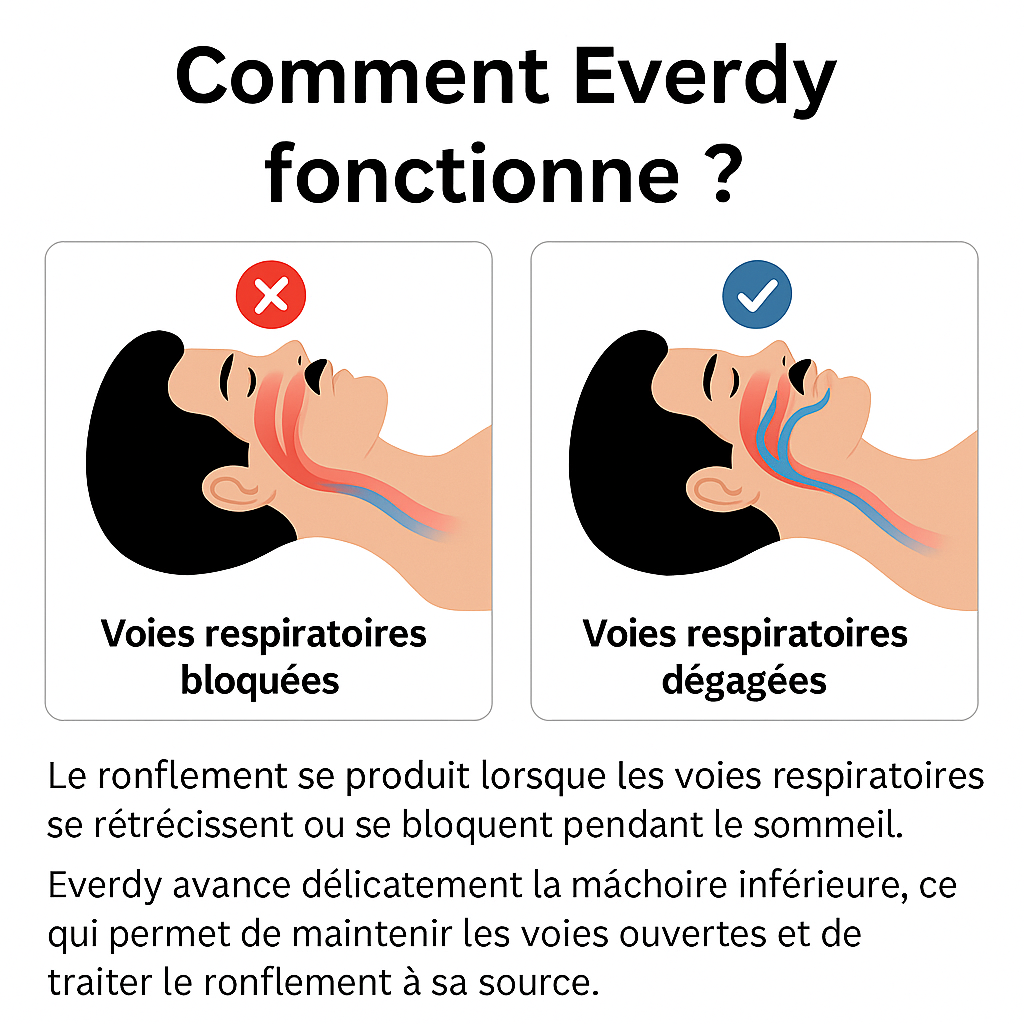Dispositif Anti-Ronflement - Everdy™